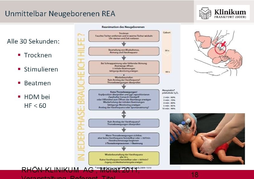 Unmittelbar Neugeborenen REA Alle 30 Sekunden: Trocknen Stimulieren Beatmen HDM bei HF < 60