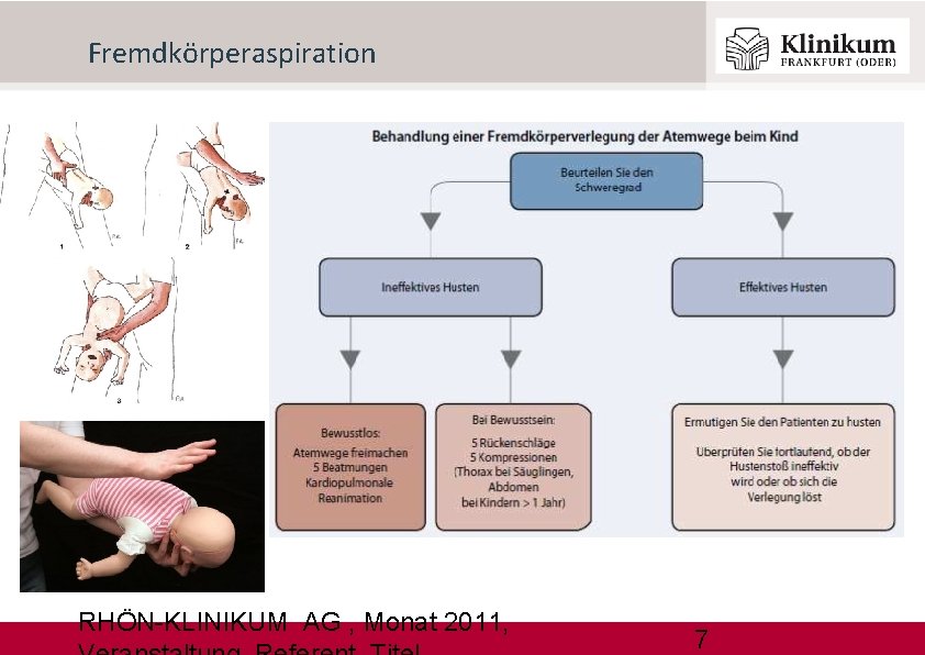 Fremdkörperaspiration RHÖN-KLINIKUM AG , Monat 2011, 7 