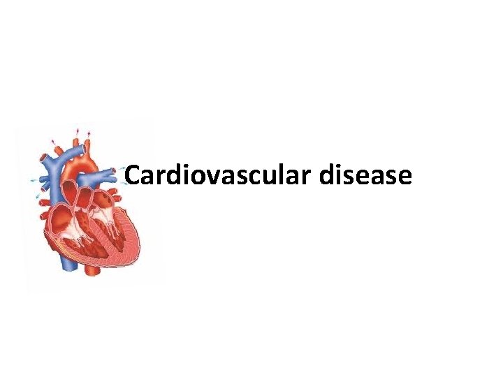 Cardiovascular disease 