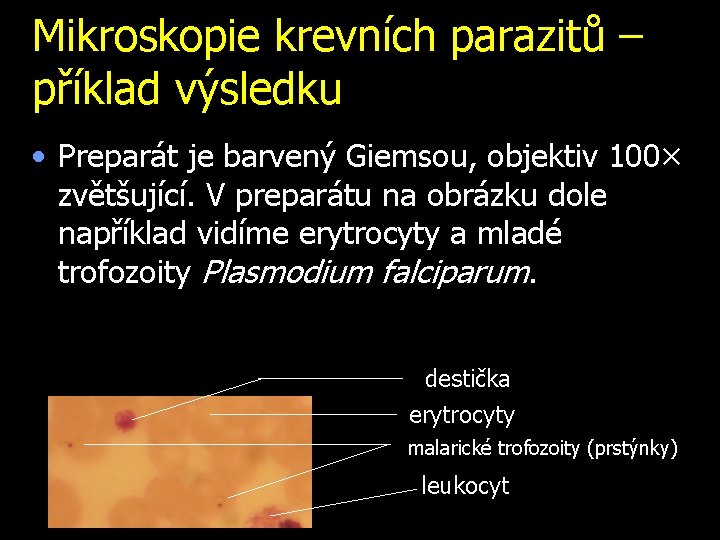 Mikroskopie krevních parazitů – příklad výsledku • Preparát je barvený Giemsou, objektiv 100× zvětšující.