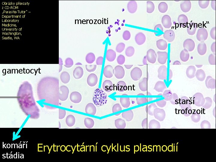 Obrázky převzaty z CD-ROM „Parasite-Tutor“ – Department of Laboratory Medicine, University of Washington, Seatle,