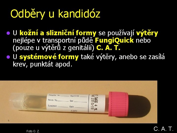 Odběry u kandidóz U kožní a slizniční formy se používají výtěry nejlépe v transportní