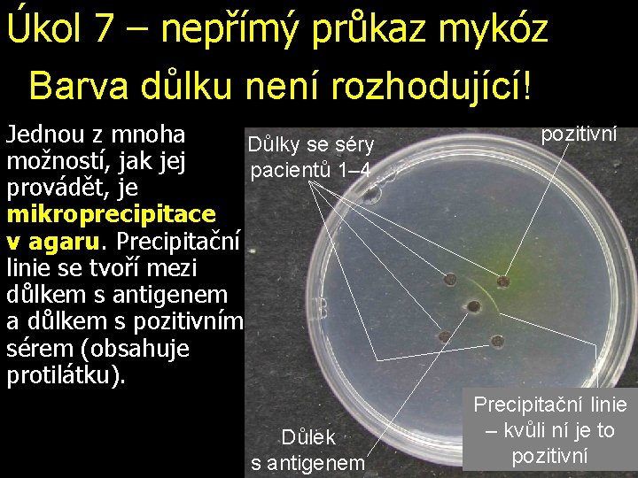 Úkol 7 – nepřímý průkaz mykóz Barva důlku není rozhodující! Jednou z mnoha Důlky