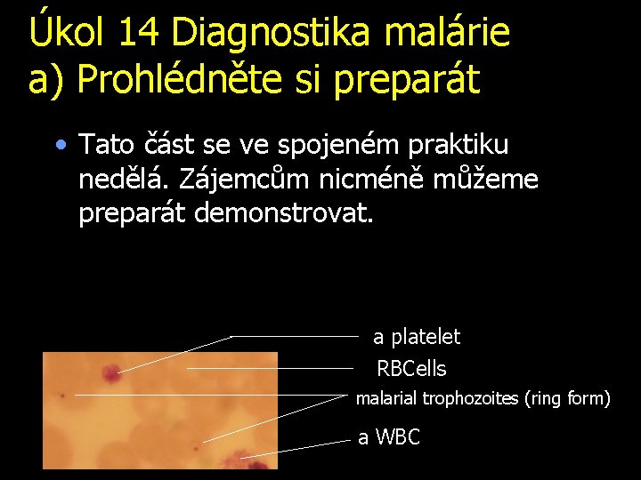 Úkol 14 Diagnostika malárie a) Prohlédněte si preparát • Tato část se ve spojeném