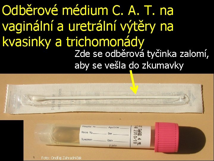 Odběrové médium C. A. T. na vaginální a uretrální výtěry na kvasinky a trichomonády