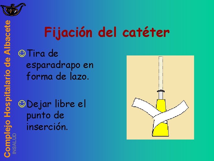 INSALUD Complejo Hospitalario de Albacete Fijación del catéter JTira de esparadrapo en forma de
