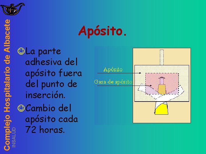 INSALUD Complejo Hospitalario de Albacete Apósito. JLa parte adhesiva del apósito fuera del punto