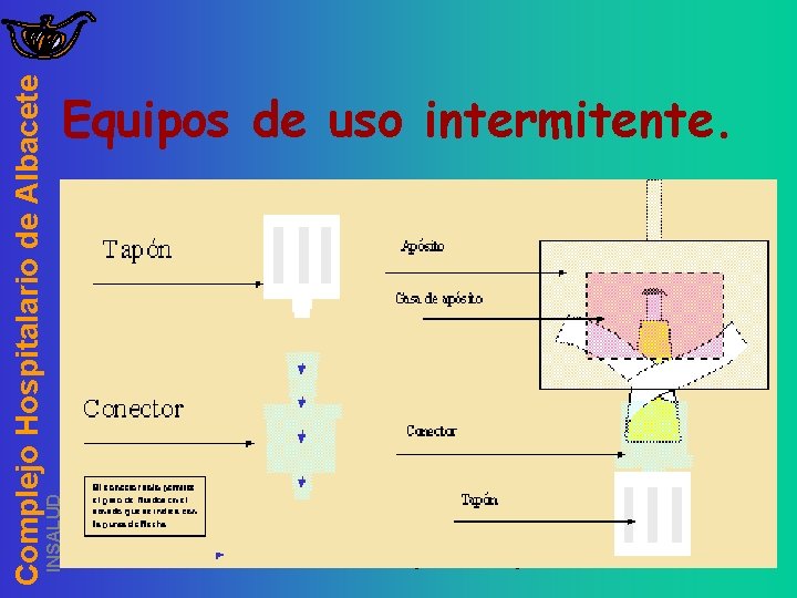 INSALUD Complejo Hospitalario de Albacete Equipos de uso intermitente. JSe purgará con solución de