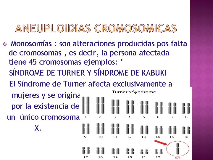 Monosomías : son alteraciones producidas pos falta de cromosomas , es decir, la persona