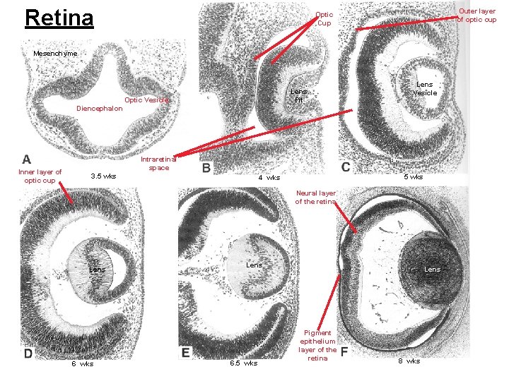 Retina Outer layer of optic cup Optic Cup Mesenchyme Lens Pit Optic Vesicle Lens