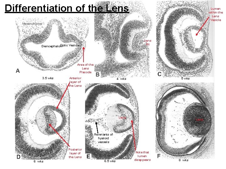 Differentiation of the Lens Lumen within the Lens Vesicle Mesenchyme Lens Pit Optic Vesicle