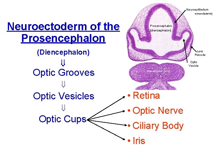 Neuroepithelium [AKA Neuroectoderm] Neuroectoderm of the Prosencephalon [diencephalon] (Diencephalon) Lens Placode Optic Vesicle Optic