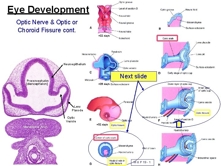 Eye Development Optic Nerve & Optic or Choroid Fissure cont. ≈22 days Neuroepithelium Next