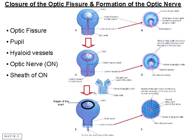 Closure of the Optic Fissure & Formation of the Optic Nerve • Optic Fissure
