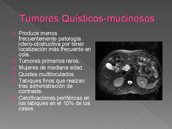 Tumores Quísticos-mucinosos � � � Produce menos frecuentemente patología ictero-obstructiva por tener localización más