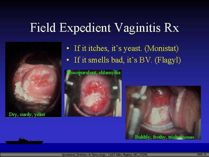 Field Expedient Vaginitis Rx • If it itches, it’s yeast. (Monistat) • If it