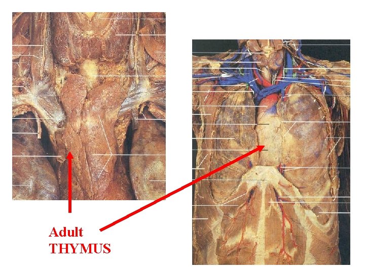 Adult THYMUS 