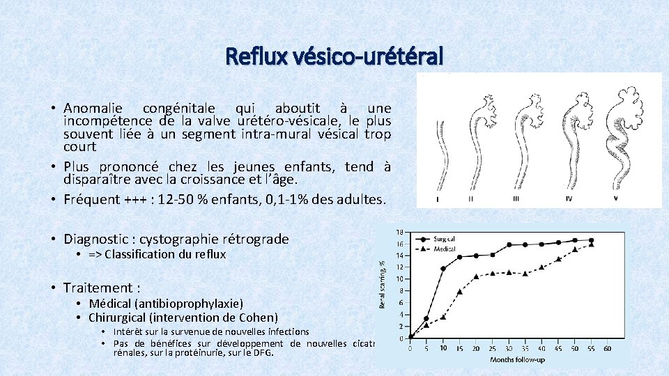 Reflux vésico-urétéral • Anomalie congénitale qui aboutit à une incompétence de la valve urétéro-vésicale,