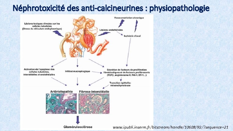 Néphrotoxicité des anti-calcineurines : physiopathologie www. ipubli. inserm. fr/bitstream/handle/10608/92/? sequence=21 