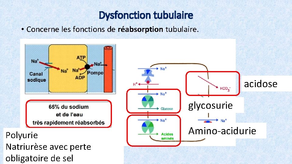 Dysfonction tubulaire • Concerne les fonctions de réabsorption tubulaire. acidose glycosurie Polyurie Natriurèse avec