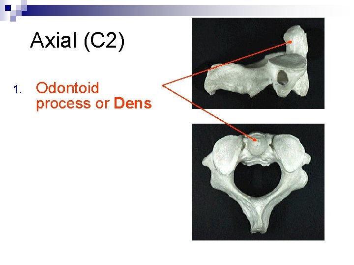 Axial (C 2) 1. Odontoid process or Dens 