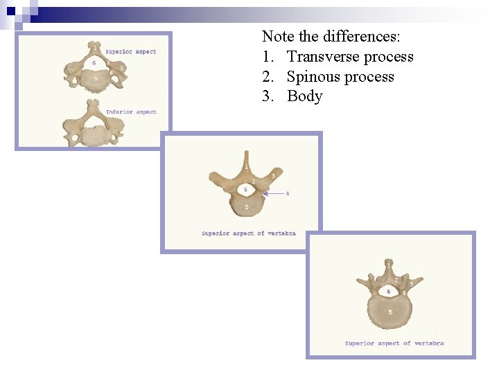 Note the differences: 1. Transverse process 2. Spinous process 3. Body 