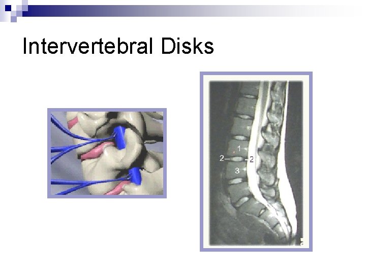 Intervertebral Disks 