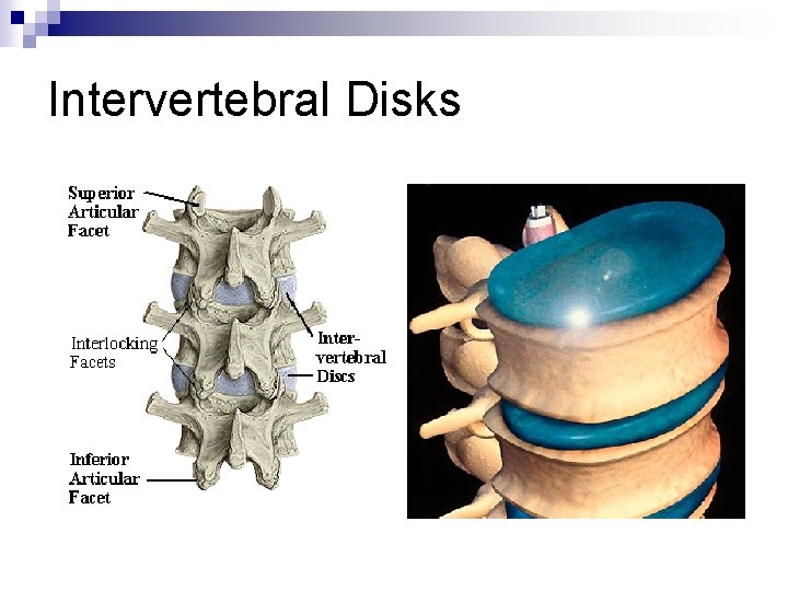 Intervertebral Disks 