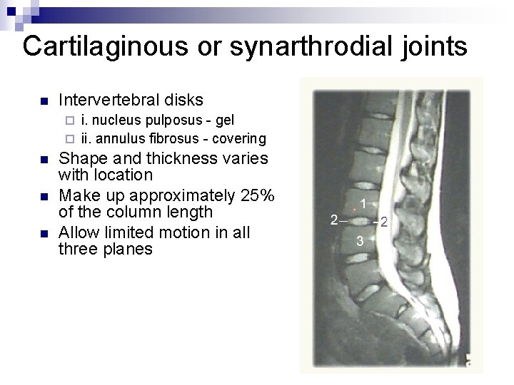 Cartilaginous or synarthrodial joints n Intervertebral disks i. nucleus pulposus - gel ¨ ii.