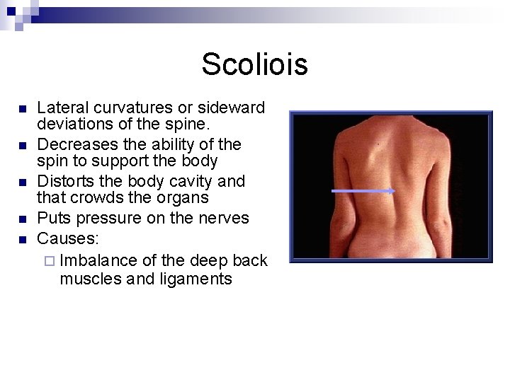 Scoliois n n n Lateral curvatures or sideward deviations of the spine. Decreases the
