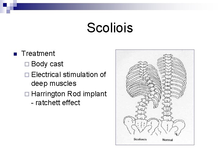 Scoliois n Treatment ¨ Body cast ¨ Electrical stimulation of deep muscles ¨ Harrington