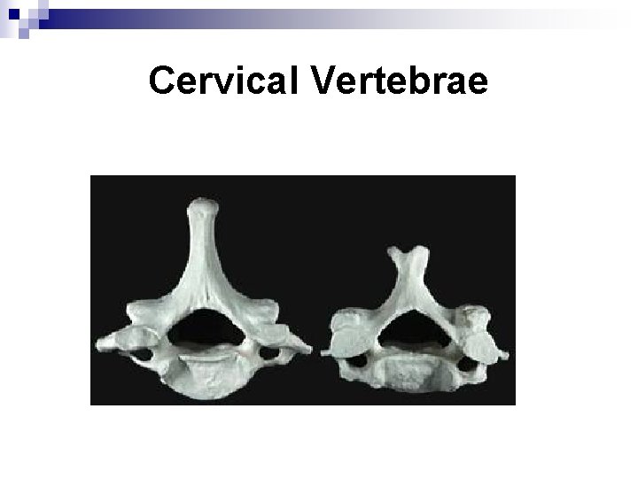 Cervical Vertebrae 