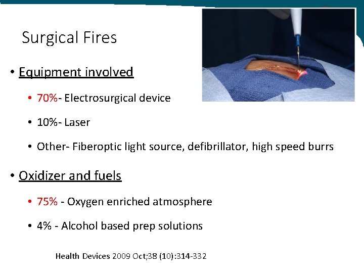 Surgical Fires • Equipment involved • 70%- Electrosurgical device • 10%- Laser • Other-
