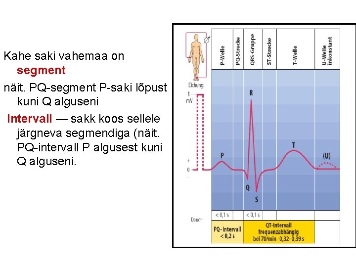 Kahe saki vahemaa on segment näit. PQ-segment P-saki lõpust kuni Q alguseni Intervall —