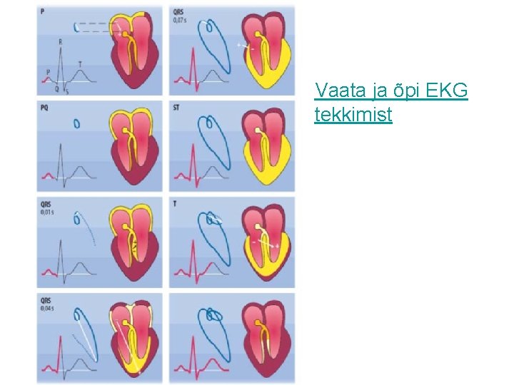 Vaata ja õpi EKG tekkimist 