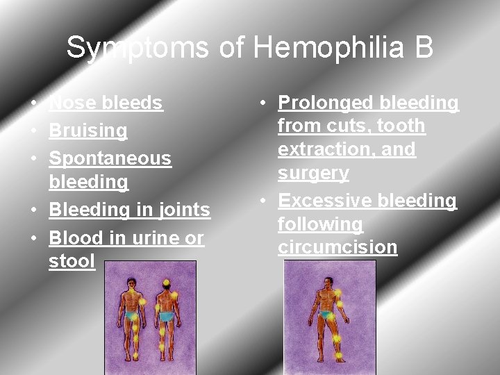 Symptoms of Hemophilia B • Nose bleeds • Bruising • Spontaneous bleeding • Bleeding