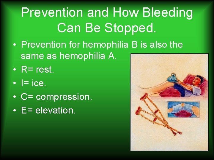 Prevention and How Bleeding Can Be Stopped. • Prevention for hemophilia B is also