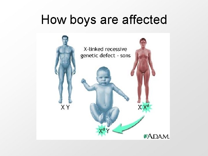 How boys are affected 