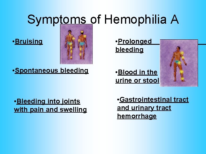 Symptoms of Hemophilia A • Bruising • Prolonged bleeding • Spontaneous bleeding • Blood