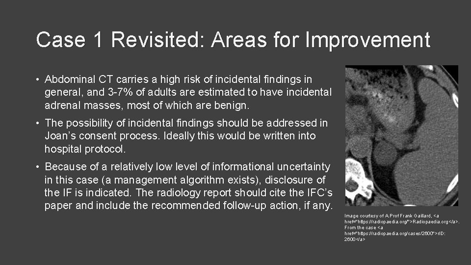 Case 1 Revisited: Areas for Improvement • Abdominal CT carries a high risk of