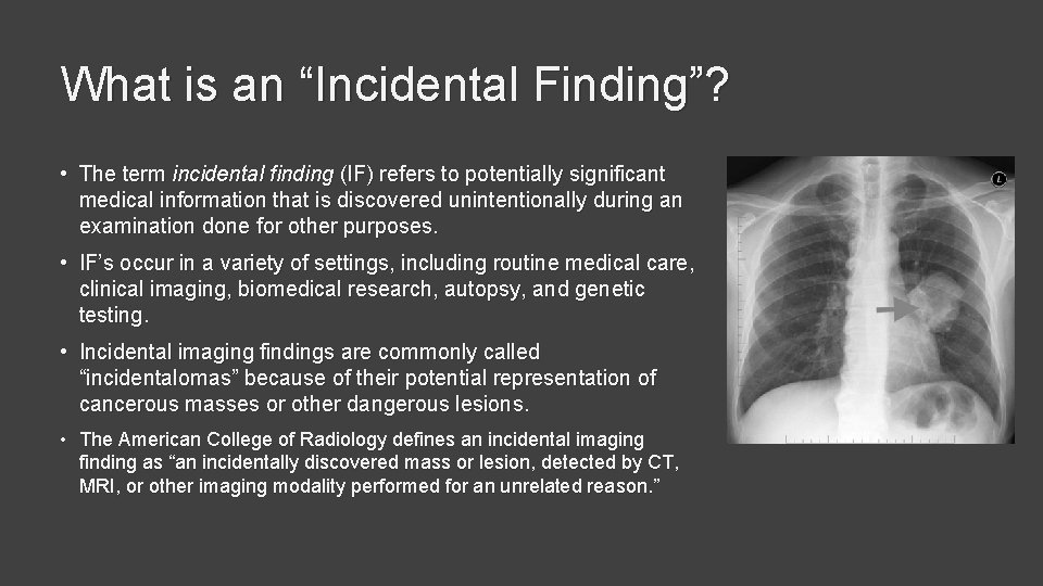 What is an “Incidental Finding”? • The term incidental finding (IF) refers to potentially