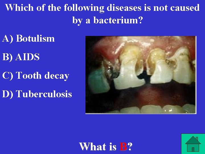 Which of the following diseases is not caused by a bacterium? A) Botulism B)
