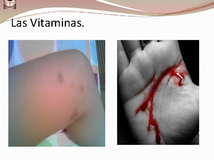 Las Vitaminas. 