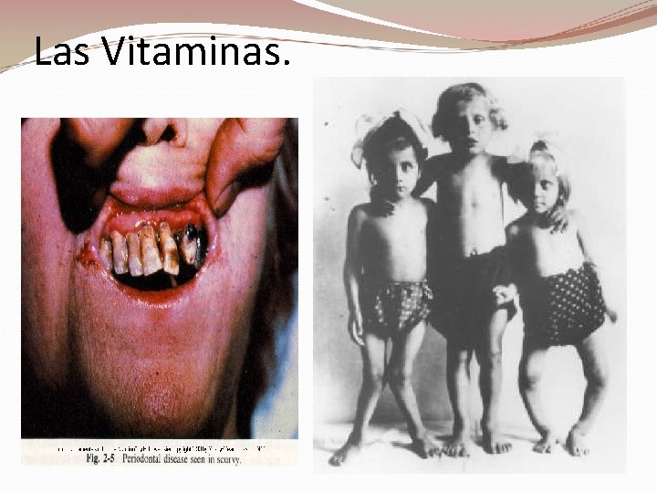 Las Vitaminas. 
