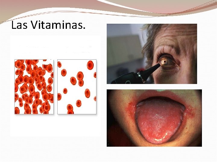 Las Vitaminas. 