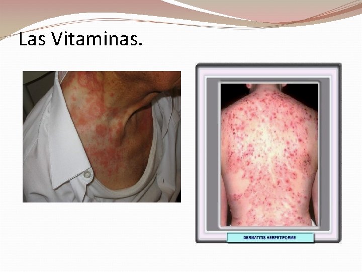 Las Vitaminas. 