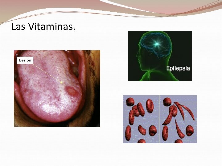 Las Vitaminas. 