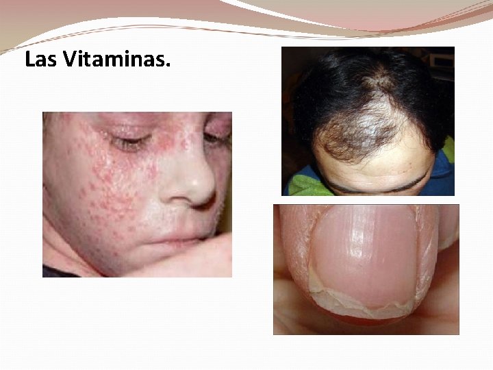 Las Vitaminas. 