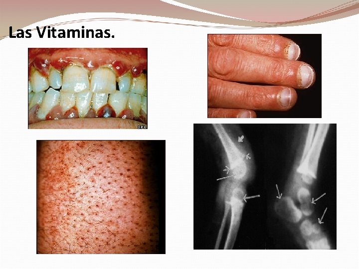 Las Vitaminas. 