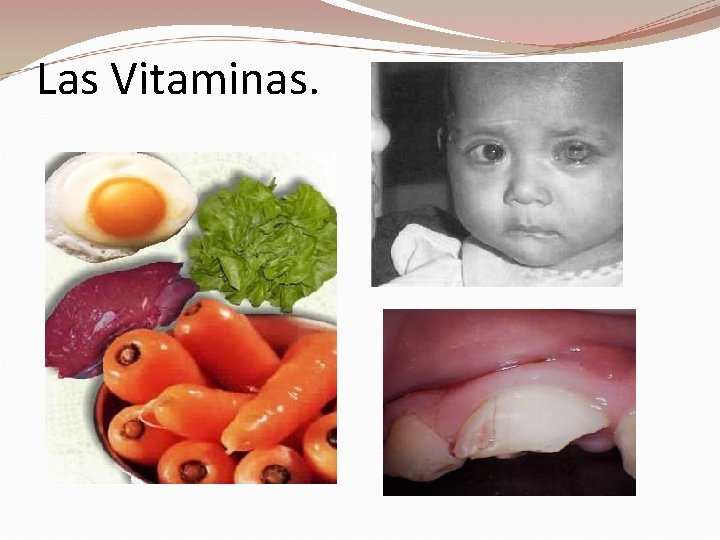 Las Vitaminas. 